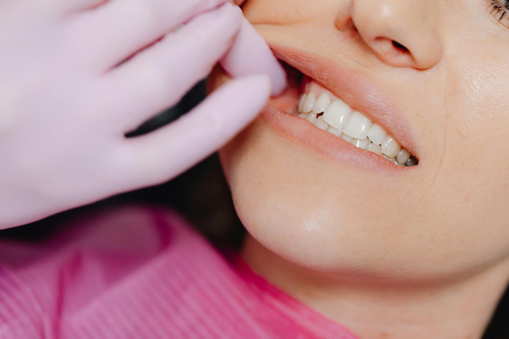 Odontología general y preventiva en UltraDental Lima