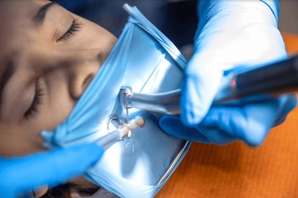 Tratamiento de conducto (endodoncia) en UltraDental Lima